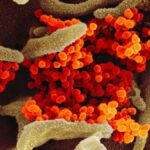 Electron Microscope Image Shows COVID-19 Virus