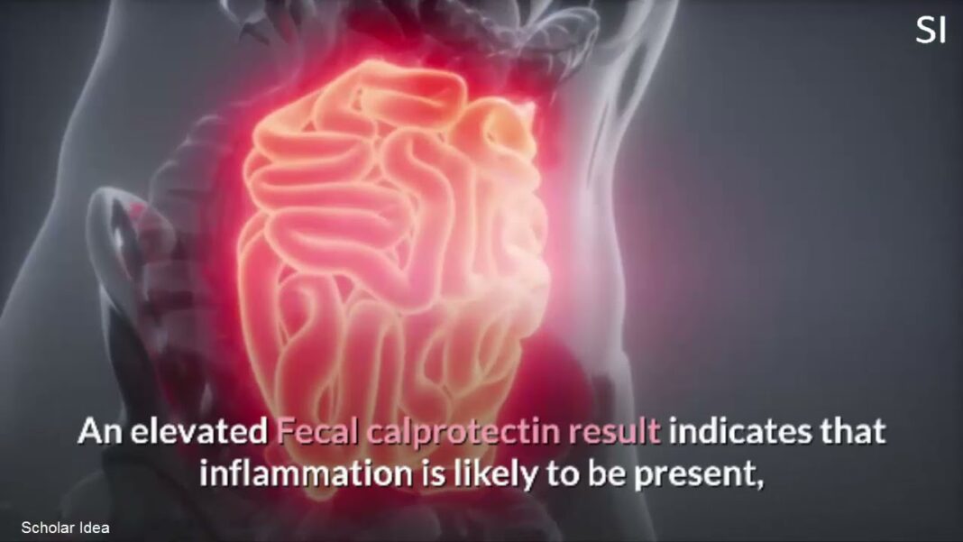 What is a Calprotectin test?