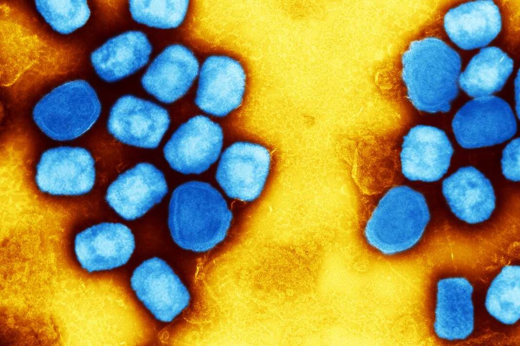 The mpox virus (blue) could be poised again for a global outbreak.