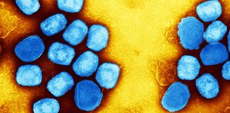 The mpox virus (blue) could be poised again for a global outbreak.